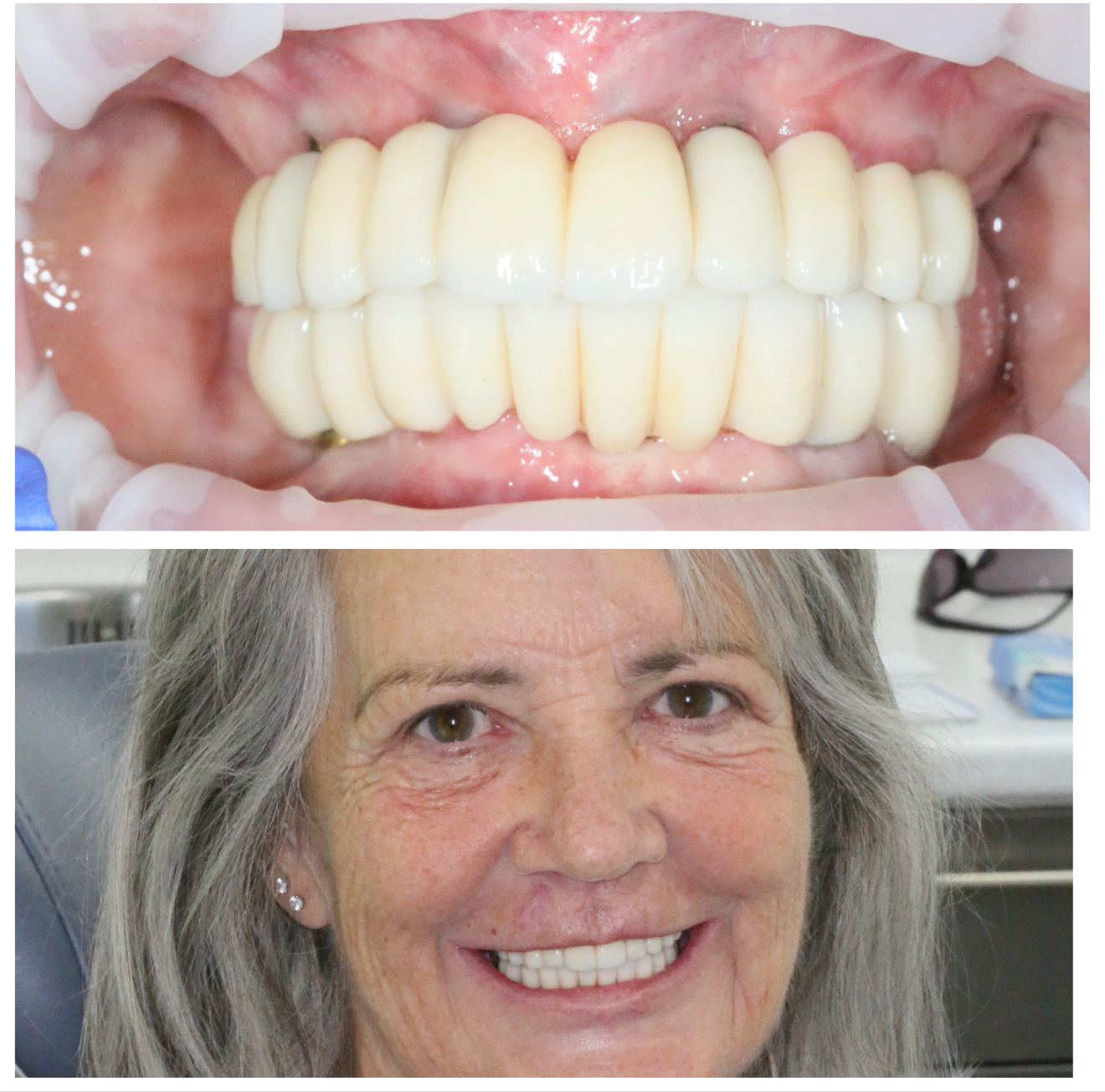Care Dental Surgery Leicester gallery image 4