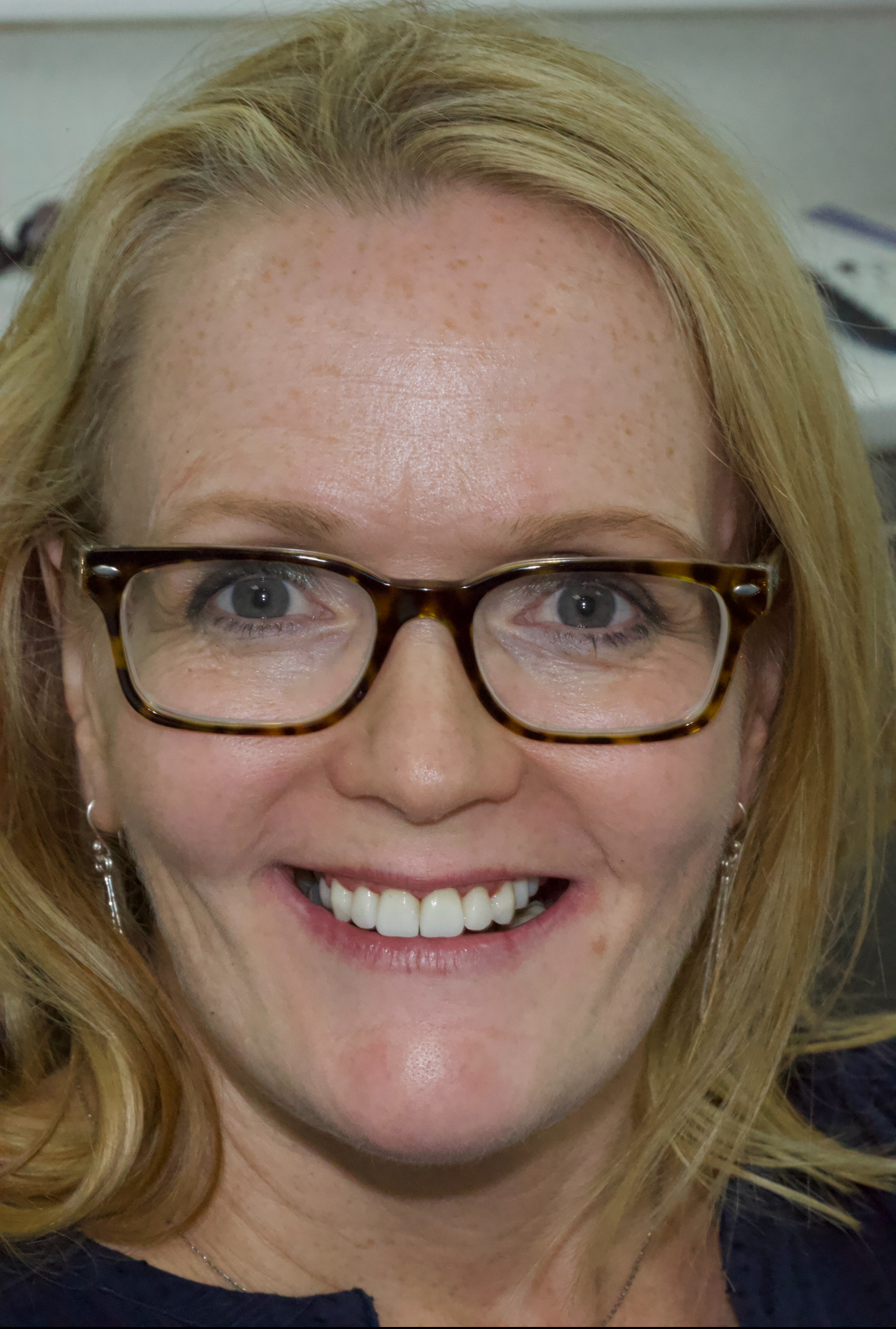 Care Dental Surgery Leicester gallery image 6